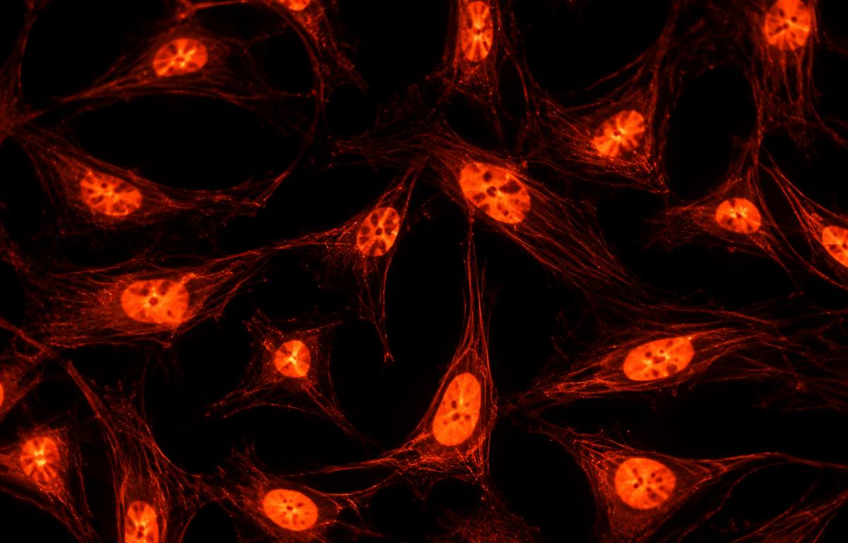 Fluorescence microscopy style image of human endothelial cells with glowing nuclei