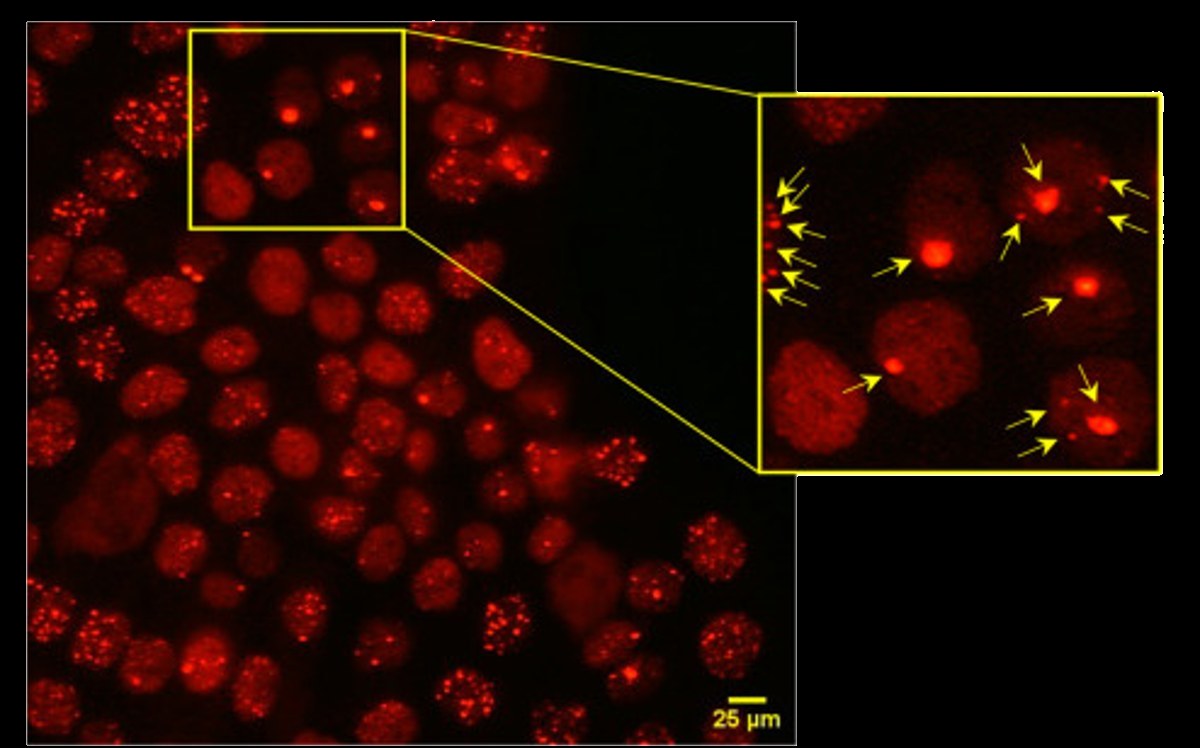Fluorescence microscopy image of human keratinocyte nuclei with 53BP1 DNA-damage foci marked by arrows