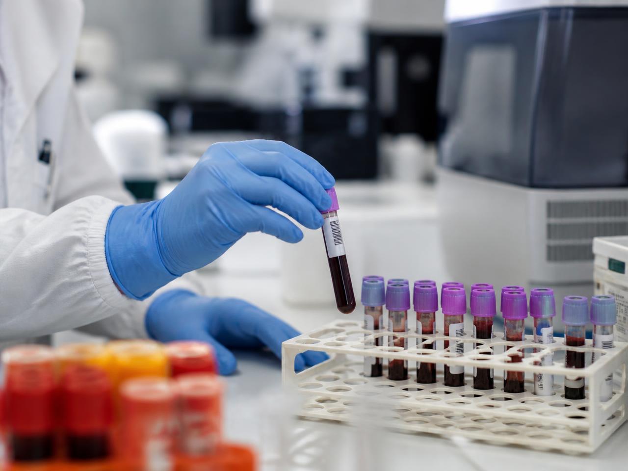 Laboratory technician handling a blood sample tube in a research lab