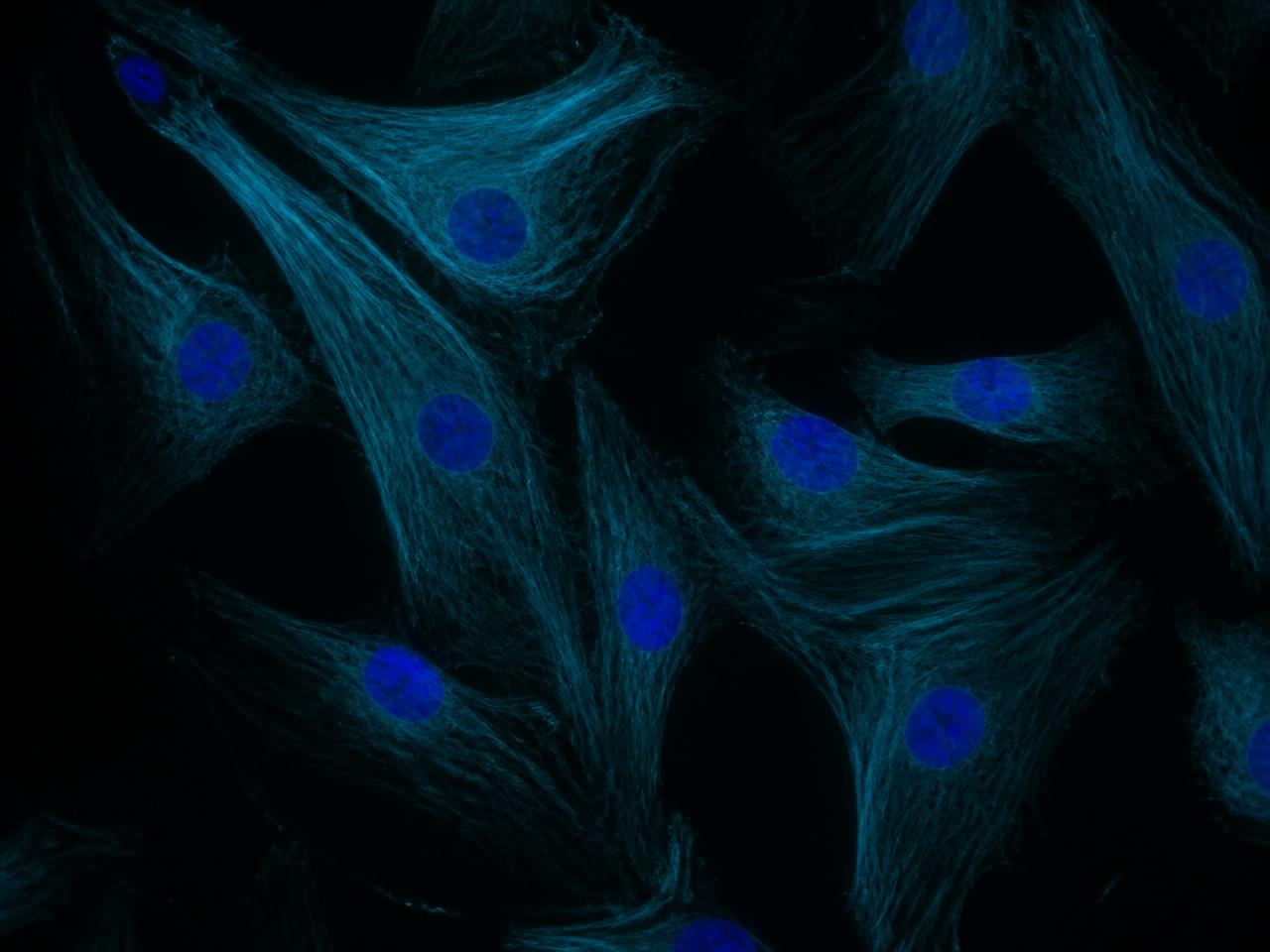Fluorescence microscopy of cultured human cells