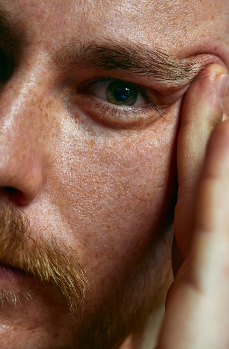 Close-up of freckled skin with visible firmness